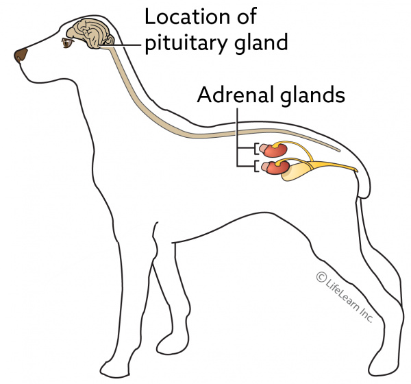 What is Addison's Disease