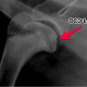 Osteochondritis Dissecans (OCD) in German Shepherds